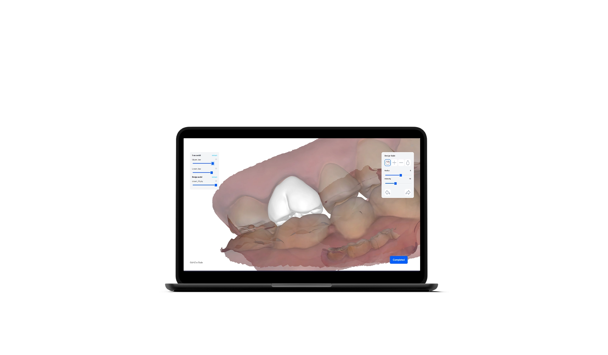 UP3D Lab Solution | Flujo completo CAD/CAM dental para cualquier ...