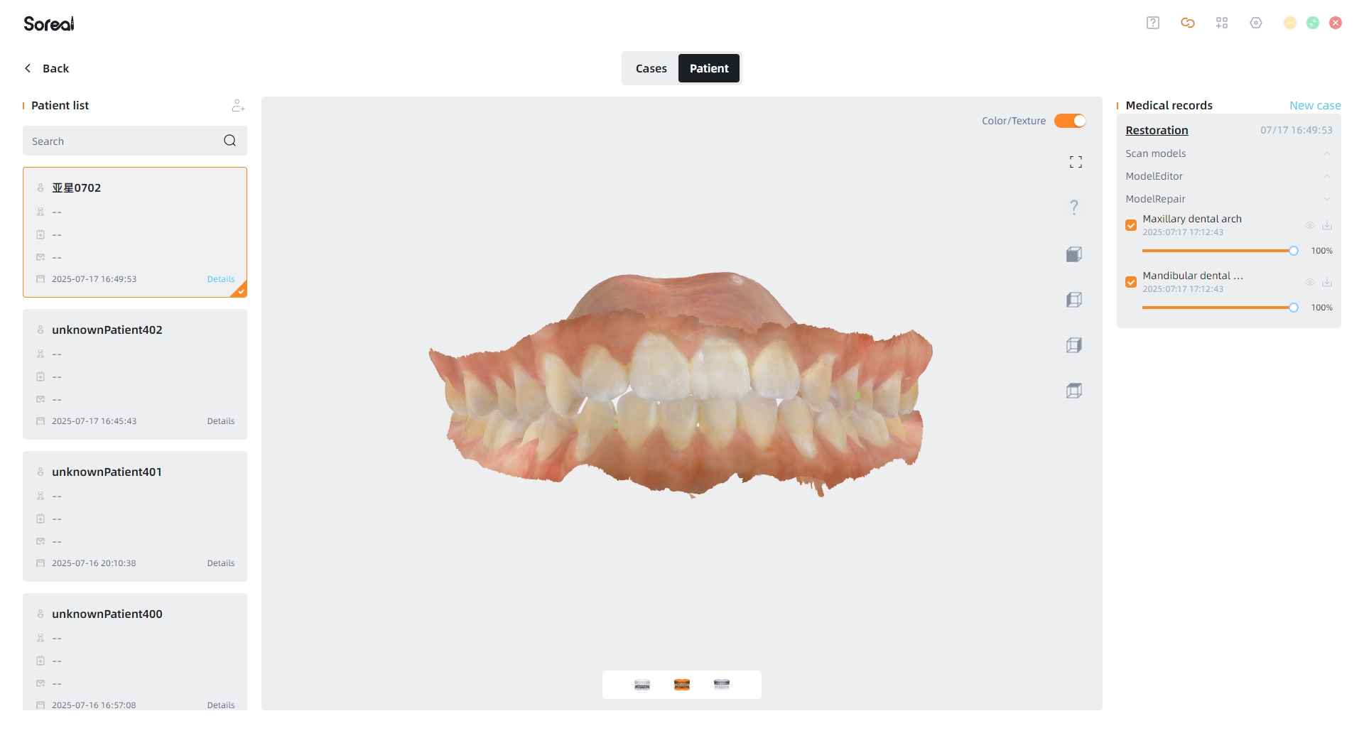 UP3D UP610 intraoral scanner intelligent patient management system for tracking treatment progress and organizing patient histories efficiently.