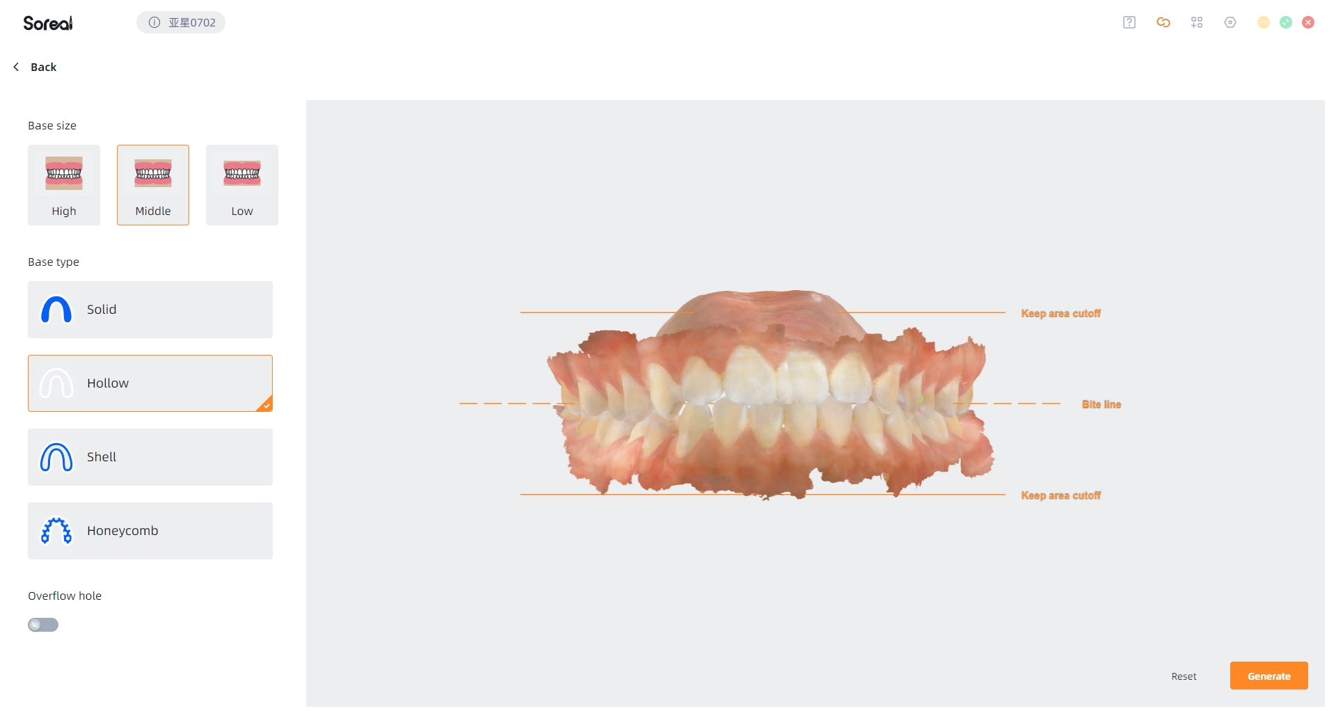 UP3D UP610 intraoral scanner generate base function for creating stable dental model bases with drain holes to simplify 3D printing workflows.