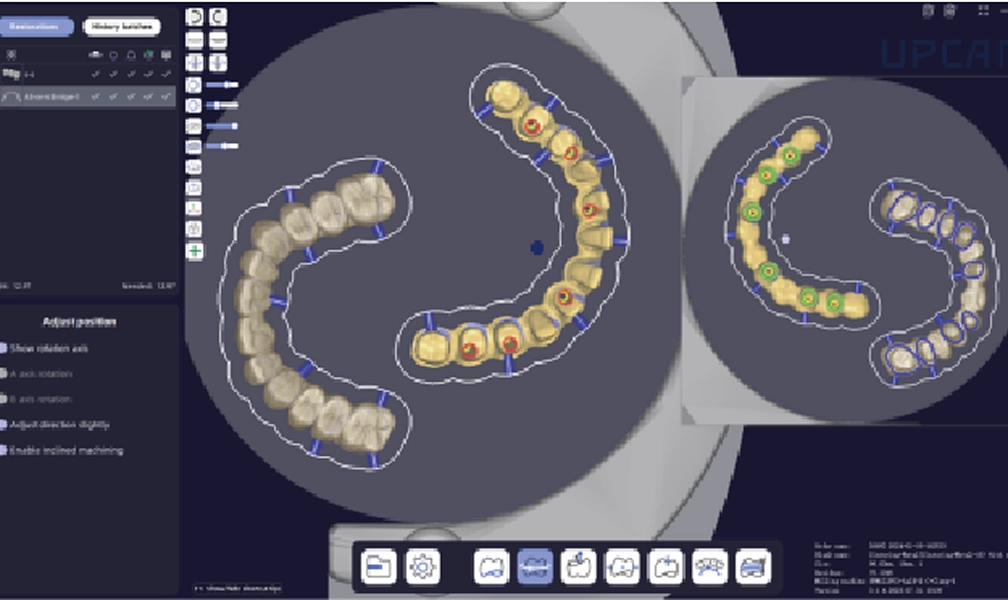 UPCAM | Smart Dental CAM Nesting Software by UP3D