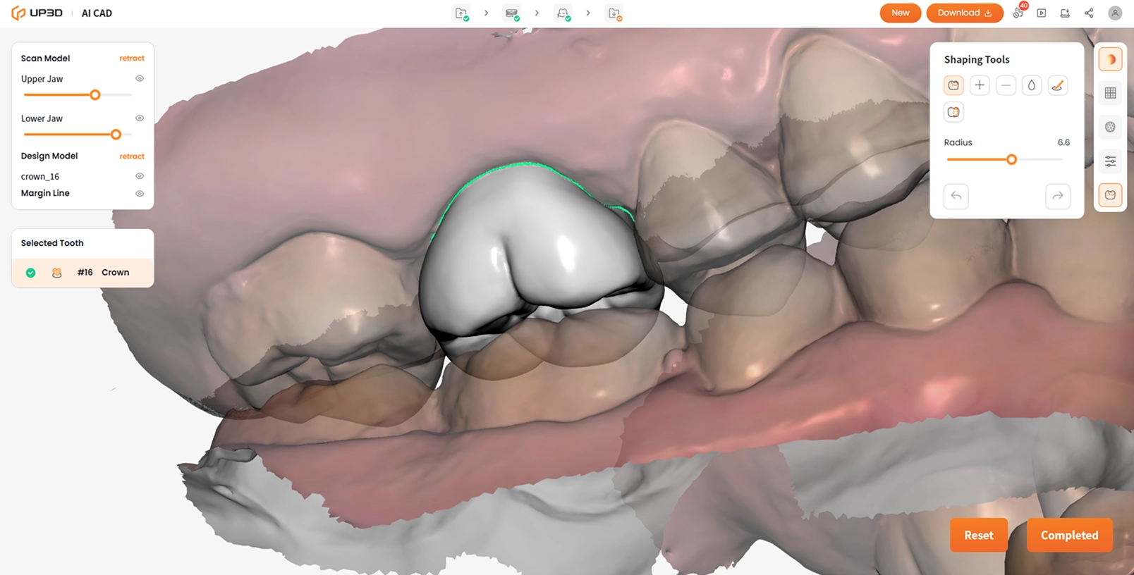 Final review and adjustments in UP3D AI CAD for precise dental crown restoration
