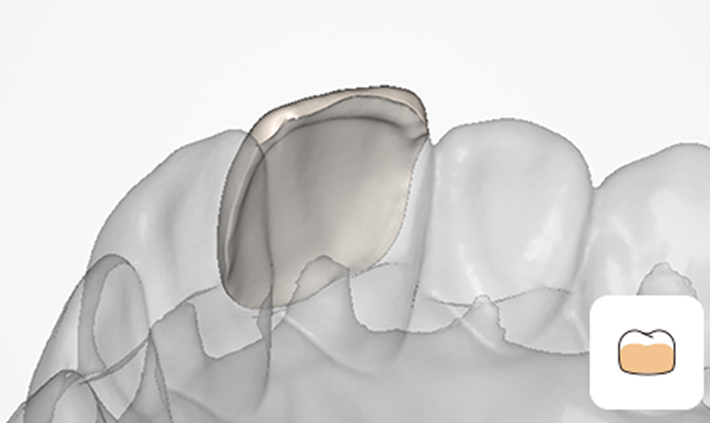 UPCAD – Smarter, Intuitive Dental CAD | UP3D